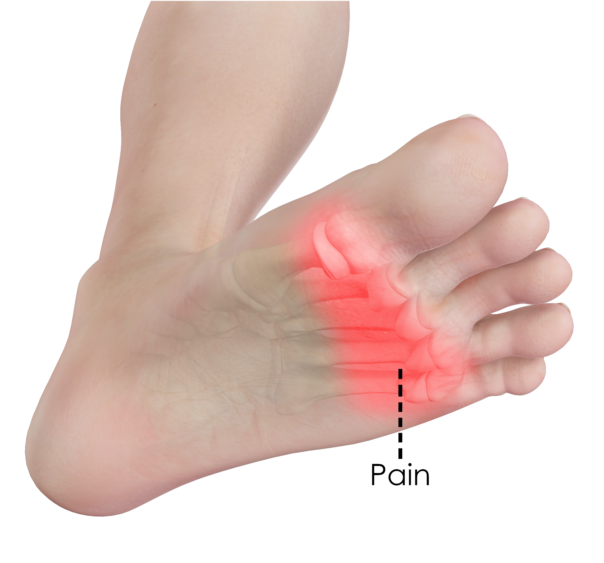 bottom of feet hurt when walking